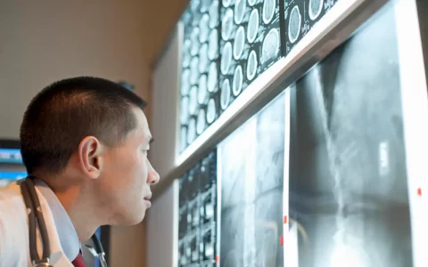 皇家墨尔本理工大学研究人员训练人工智能检测早期前列腺癌
